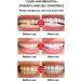 SP-6 Ultra Whitening Probiotic Toothpaste - Brightening & Effective Tooth Care for a Radiant Smile - Buy Online on GoSupps.com