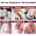 Extra Strong Fungal Nail Treatment - Nail Fungus Remover Kit with File and Brush - 20ml - Buy Online on GoSupps.com