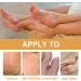 Tongyend Foot Peeling Spray Instant Foot Peeling Spray Foot Callus Removal Spray Moisturizing Hydrating Nourish Peel off Spray Foot Exfoliating Spray Remove Foot Dead Skin-30ML FootCallusRemover - Buy Online on GoSupps.com