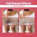 FARMSKIN Dark Spot Corrector Cream - Niacinamide & Vitamin C for Face & Body | 30 Days Miracle Solution for Underarms Knees Elbows & Sensitive Areas (50ml - Buy Online on GoSupps.com