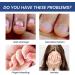 Anti Nail Biting Polish Double Head Stop and Grow Nail Biting Stop Nail Biting Nail Biting Prevention for adults anti nail biting polish Clear Nail Varnish Stop Biting Nails Nail Biter Stopper - Buy Online on GoSupps.com