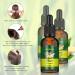 Ginger Hair Growth Serum - Stronger, Thicker, Longer Hair - Thinning Treatment - 3 Pack 30ML - Buy Online on GoSupps.com