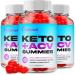 (3 Pack) Optimal Keto ACV Gummies Optimal ACV + Keto Advanced Keto Formula Shark Plus Apple Cider Vinegar Keto Tank Gummies Oprah Dietary Supplement B12 Beet Root Juice Men Women (180 Gummies)