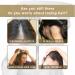 Yeeda Rosemary Bar Shampoo 2 Pieces Hair Regulating Shampoo Bar Soap Hair Growth Shampoo Bar for Fine and Oily Hair Hair Loss - Buy Online on GoSupps.com