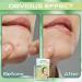 216PCs Hydrocolloid Pimple Patches - Invisible Waterproof Acne Treatment for Fast Healing | Two Sizes Available - Buy Online on GoSupps.com