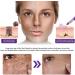 JIAOY EPIGLOW Advanced Pigmentation Cream Tone Correction Moisturizer EPIGLOW Pigmentation Treatment Cream AntiAging Face Removes Dark Spots Skin Buildup 6 Pack 6 Pack - Buy Online on GoSupps.com