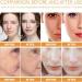 Multi-Peptide + HA Serum for Face Hydrating Hyaluronic Acid Serum Firming Face Serum for Women Anti Aging Serum for Face Skincare Serum for Fine Lines & Wrinkles Smoothing &Lightening Facial Serum - Buy Online on GoSupps.com