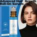 Advanced Hair Care Serum Roll 10ml Promotes Hair Growth Reduces Hair Loss Nourishes Hair Enriched with Mint Oil Vitamin E and Natural Oils for Men and Women1pc - Buy Online on GoSupps.com