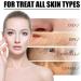 Retinol Serum for Face - Coffee Extract Face Serum - Anti-Aging & Anti Wrinkles Face Serum for Women - Vitamin C Serum for Face - Face Care Squalane Hydrating Serum - Facial Serum - Skin Care Serum - Buy Online on GoSupps.com