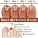 7 Days Nail Growth Serum Set - Repair & Strengthening Cuticle Oil for Damaged Nails - Buy Online on GoSupps.com