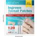 Ingrown Toenail Patch Ingrown Toenail Corrector | Toenail Repair to Relieve Nail Groove Nail Correction Patches Suitable for Men Women and Elderly Adern - Buy Online on GoSupps.com