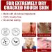 Bexdug Foot Peeling Mask - Exfoliating Peeling Socks for Soft Smooth Feet | Moisturizing Treatment & Dead Skin Remover | Heel Repair | 1 Piece - Buy Online on GoSupps.com