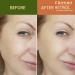 Retinol Anti-Wrinkle Facial Serum Concentrate - Improve Elasticity Tone & Minimize Fine Lines - Age-Defying Formula for Youthful Skin - Buy Online on GoSupps.com