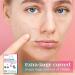AUSLKA Pimple Patches for Chin & Cheeks - 18 Hydrocolloid Blemish Patches - Buy Online on GoSupps.com