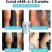 Cr me de R paration Articulaire l'Acide Hyaluronique Arthroheal Cr me de Soulagement de la Douleur Arthroheal Cr me Articulaire et Osseuse l'Acide Hyaluronique Cr me de Th rapie Articulaire et 2 pi ces. 50 g (Lot de 1) - Buy Online on GoSupps.com