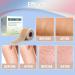 Silicone Scar Sheets 1.6x120 Tape Roll - Keloid & Surgical Scar Removal Treatment - Buy Online on GoSupps.com