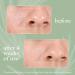 Buy Honest Beauty Get Clarity Cream to Foam Acne Cleanser for Oily Skin | Vegan Cruelty-Free Colloidal Sulfur & Apple AHAs | 4 fl oz - Buy Online on GoSupps.com