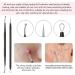 Xesscare 7-Piece Pimple Popper & Blackhead Remover Tool Kit - Acne Extractor & Tweezers for Facial, Nose, and Forehead - Blemish & Whitehead Removal (Black) - Buy Online on GoSupps.com
