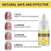 Tbeautfave Fungal Nail Treatment Nail Fungus Treatment for Toenail Ginseng Nail Treatment Essence Nail Growth Treatment Relief Oil Nail Repair Solution Toenail Oil Treatment Nail Care - Buy Online on GoSupps.com