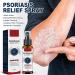 GFOUK Natural Eczema Therapy Spray All Natural Eczema Treatment Psoriasis Treatment Vitiligo Skin Repair Spray Skin Care Pain & Itch Spray Fast Acting Itch Relief (2 Pcs) - Buy Online on GoSupps.com
