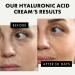 Eclat Skincare Hyaluronic Acid Face Cream Hyaluronic Acid with Retinol, Vitamin C & E oisturizer, Hyaluronic Acid - 1.7 Fl Oz - Buy Online on GoSupps.com