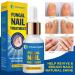 Fungal Nail Treatment - Natural Antifungal Solution for Toe Fungus - 1oz/30ml - Buy Online on GoSupps.com