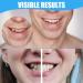 Frenzify Tooth Bleaching Set - Cosmetic Teeth Lightening with Top & Bottom Veneers Box & Pincers for Bad Teeth - International Shipping Available - Buy Online on GoSupps.com