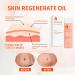 Optimal Oil Stretch Mark Oil Body Oil for Women Stretch Marks Removal Body Oil Collagen Boost Firming & Lifting Skincare Oil Anti Stretch Mark Cream Pregnancy Nuture Nourishing Skin Treatment Oil - Buy Online on GoSupps.com