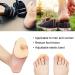 4-Piece Hammer Toe Support & Splint Set for Hammer Toes & Claw Toes - Buy Online on GoSupps.com