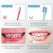 Fregum V-Shaped Orthodontic Toothbrush for Braces - Soft Bristles (6 Count) - Buy Online on GoSupps.com