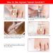 NUNALISA Ingrown Toenail Treatment Kit - Premium Toenail Removal Set with Clippers, File, Pusher, Corrector for Thick & Ingrown Nails - Professional Peticure Tool Included - Buy Online on GoSupps.com