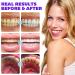 70PCS Purple Toothpaste Tablets | Toothpaste Tablets | Remineralizing Tablets with Nano-Hydroxyapatite (nHa) for Teeth Whitening Oral Care Natural Whitening Peppermint - Buy Online on GoSupps.com