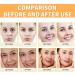 Vitamin C Moisturiser For Face Cream Face Moisturiser Vitamin C Facial Moisturiser Day And Night Cream For Women Brighten Tone Face Brightening Cream Brighten Anti Wrinkle Cream Skin Lightening Cream - Buy Online on GoSupps.com
