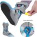 Shop Large Right Walking Boot for Sprained Ankle - Adjustable Ankle Support Brace for Rehabilitation | International Shipping Available - Buy Online on GoSupps.com