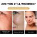 Snail Mucin Moisturiser Snail Cream Snail Mucin Cream with Hydrolyzed Collagen and Snail Filtrate Extract Anti Aging Face Cream for Hydrating Anti Wrinkles - Smooth Fine Lines - Anti Aging - Buy Online on GoSupps.com