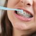 Trim Toothbrush & Interdental Brushes for Braces | Small Rounded Head | Premium Oral Hygiene Tools - Buy Online on GoSupps.com
