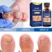 Extra Strength Toe Nail Fungus Treatment - Effective Nail Repair Solution for Healthy Nails - Buy Online on GoSupps.com