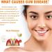 Gum Repair Treatment Ampoules Oral & Gum Care Essence for Tartar Removal Tooth Repair & Gum Protection. (2box) - Buy Online on GoSupps.com