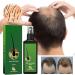 Hair Growth Serum Hair Lotion Hair Loss Treatments for Men Women Promotes Hair Thicker and Stronger Natural Nourishing Hair Growth Spray Hair Care for Dry Damaged Hair. (120ml) - Buy Online on GoSupps.com