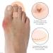 GLSTOY Insoles 4pcs - Supports Foot Alignment, Bunion Splint Pads, Toe Separators - Light Yellow 10.5x7x0 - Buy Online on GoSupps.com