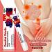 2023 Herpes Remover & Wart Ointment - Genital & Vulva Treatment (20g 2 PCS) - Effective Condyloma Acuminatum Relief - Fast International Shipping - Buy Online on GoSupps.com