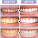 Teeth Whitening Pens 3 Pack - 4 ml Stain Removal | USA Seller | Freshen Breath & Brighten Smile - Buy Online on GoSupps.com