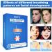 Acotye 2 in 1 Anti-Snoring Solution: Mouth Tape and Nasal Strips - 142pcs | Relief and Improve Nighttime Sleeping Hypoallergenic - Buy Online on GoSupps.com