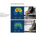 YUNYEUNG Electric Massage Wheelchair Cushions for Pressure Relief and Ulcer Prevention - Pain Relief Air Seat Cushion for Extended Sitting - Buy Online on GoSupps.com