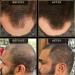 Hairline Powder by The Beard Struggle - Root Touch Up Hair Color for Men | Conceals Hair Loss & Bald Spots | Sweat Resistant Dark Brown - Buy Online on GoSupps.com