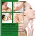 Light Skincare Facial Cream All-in-1 Radiant Moisturising Cream Deeply Hydrating Long-lasting Facial Moisturizer Smooth Lines & Boost Glow Anti-aging Essence Cream Skincare Gift for Women - Buy Online on GoSupps.com