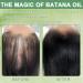 Batana Oil Batana Oil for Hair Pure Batana Oil Batana Oil for Hair Contains 100% Batana Oil Batana Oil for Hair Makes Hair Thicker (100G) - Buy Online on GoSupps.com