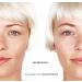 Magicstripes Large Eyelid Correction Patches - 64 Pieces for Instant Lift & Perfect Eyes | Shop Now! - Buy Online on GoSupps.com