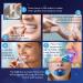 MagicBrite LED Teeth Whitening Kit - 35% Carbamide Peroxide, 2 Mouth Trays, (3) 3ml Gel Syringes - Buy Online on GoSupps.com