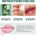 Mouth Ulcer Treatment Spray Mouth Ulcer Spray Mouth Ulcer Relief Spray Canker Sore Treatment Ulcer Treatment Tongue Breath Spray for Bad Breath Ulcer Treatment Canker Relief Spray Mouth Freshener - Buy Online on GoSupps.com